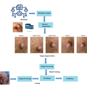Impact of Fuzziness for Skin Lesion Classification with Transformer-Based Model