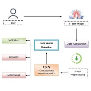 LCDctCNN: Lung Cancer Diagnosis of CT scan Images Using CNN Based Model