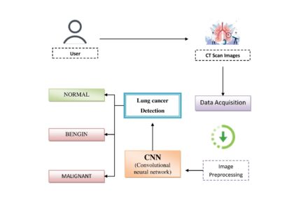 LCDctCNN: Lung Cancer Diagnosis of CT scan Images Using CNN Based Model